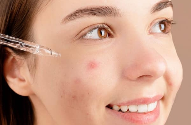 cac-loai-serum-tri-mun Một số lưu ý khi lựa chọn serum trị mụn