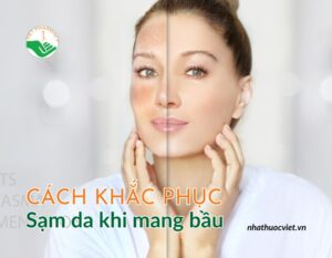 cach-khac-phuc-sam-da-khi-mang-bau