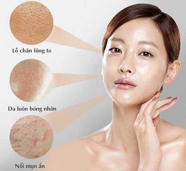 da-dau-mun-co-nen-dung-kem-chong-nang Da dầu mụn có nên dùng kem chống nắng?