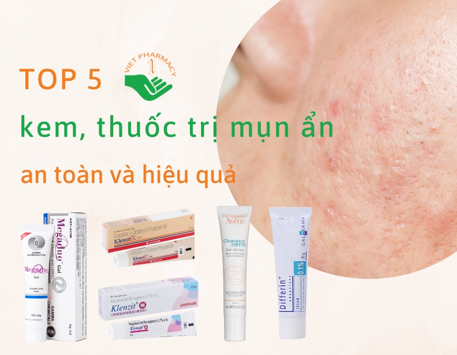 kem-thuoc-tri-mun-an-hieu-qua-duoc-bac-si-khuyen-dung-1 Top 5 kem trị mụn ẩn được bác sĩ khuyên dùng