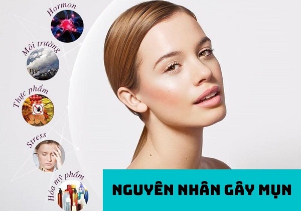 Nguyên nhân gây mụn