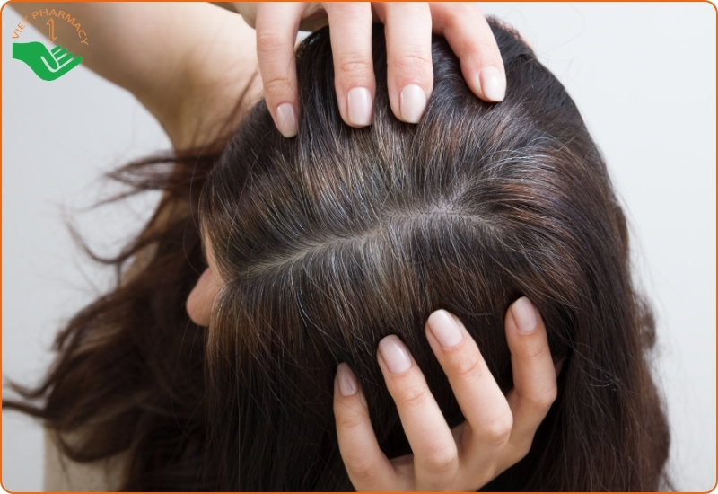 Tóc bạc sớm là gì?