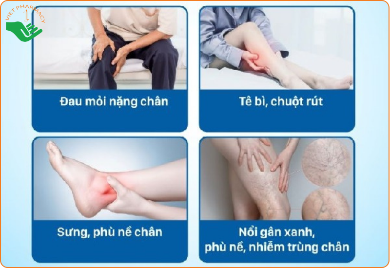 Triệu chứng của suy giãn tĩnh mạch