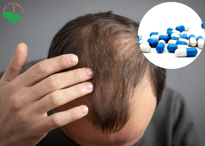 Lưu ý khi dùng thuốc kích mọc tóc