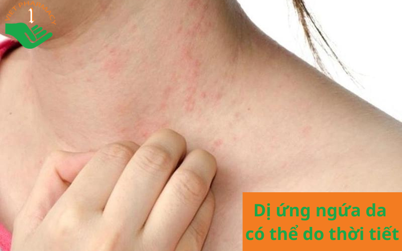 Nguyên nhân gây dị ứng ngứa da do thay đổi thời tiết