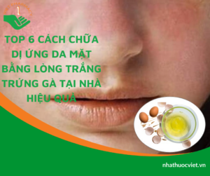 cach-chua-di-ung-da-mat-bang-long-trang-trung-ga