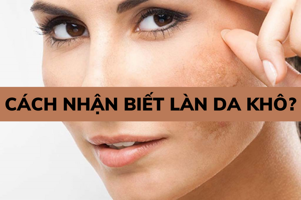 Cách nhận biết làn da khô?