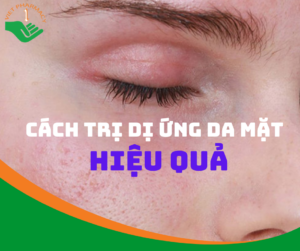 cach-tri-di-ung-da-mat