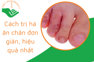 cach-tri-ha-an-chan-don-gian-hieu-qua-nhat