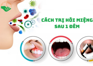cach-tri-hoi-mieng-sau-1-dem
