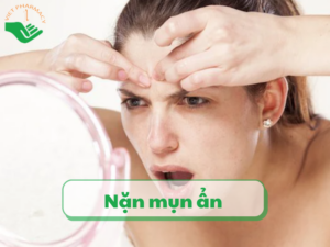 Cách đẩy và nặn mụn ẩn tại nhà giúp da mịn màng cach-tri-mun-boc