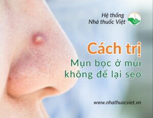 cach-tri-mun-boc-o-mui-tai-nha-khong-de-lai-seo