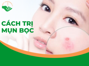 cach-tri-mun-boc201