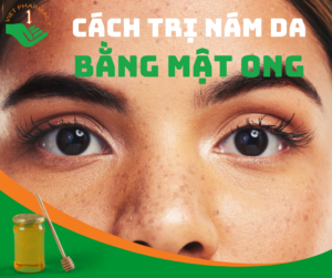 cach-tri-nam-bang-mat-ong-hieu-qua-va-an-toan