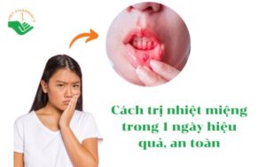 cach-tri-nhiet-mieng-trong-mot-ngay-hieu-qua-an-toan