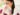 cach_chua_ho_di_ung_don_gian_tai_nha_1