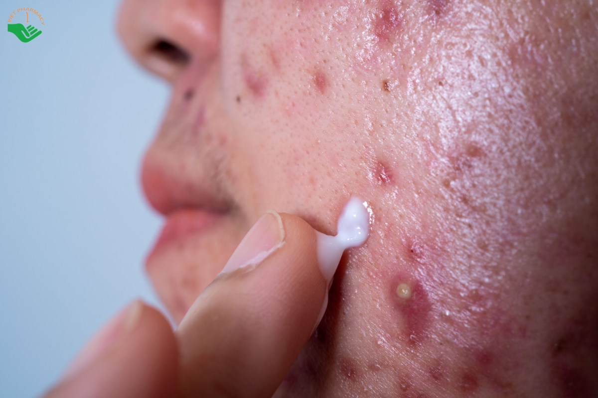 Cần tuân theo liều lượng khi sử dụng các loại thuốc trị mụn bọc