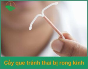cay-que-tranh-thai-bi-rong-kinh-thumb