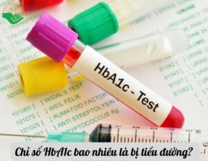 chi-so-hba1c-bao-nhieu-la-bi-tieu-duong-thumbnail