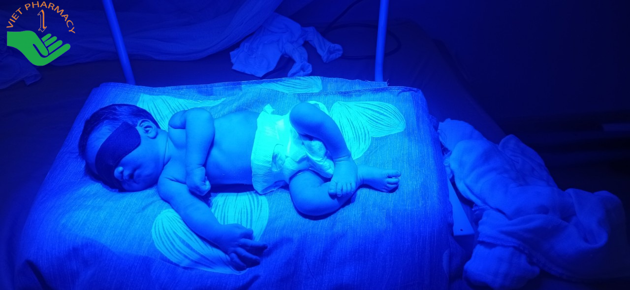Chiếu đèn điều trị vàng da ở trẻ sơ sinh