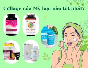 collage-cua-my-loai-nao-tot-nhat