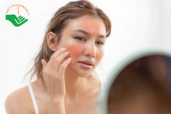Da bị cháy nắng gây khô ráp, sạm màu, bong tróc và có thể xuất hiện mụn nước nhỏ