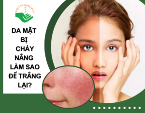 da-mat-bi-chay-nang-lam-sao-de-trang-lai-thumb