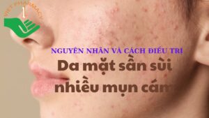 da-mat-san-sui-nhieu-mun-cam-1-1