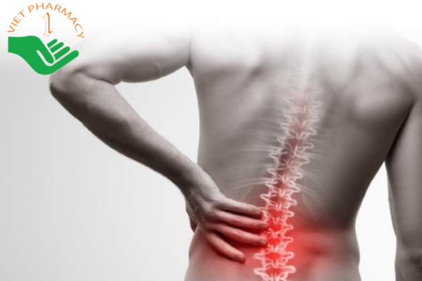 Đau lưng ở người trẻ cần nghĩ đến nguyên nhân viêm cột sống dính khớp