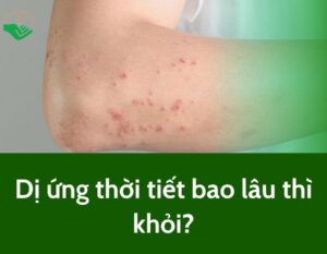 di-ung-thoi-tiet-bao-lau-thi-khoi