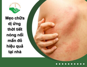 di-ung-thoi-tiet-nong-noi-man-do-thumb