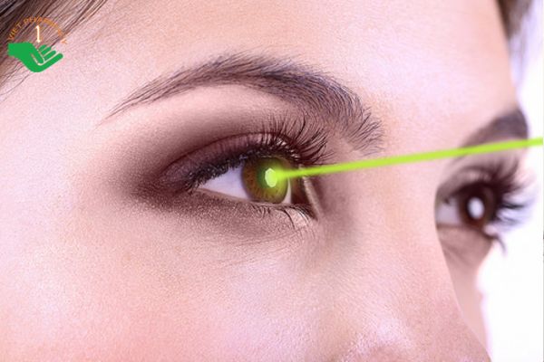 Đốt laser để loại bỏ sùi mào gà ở mắt