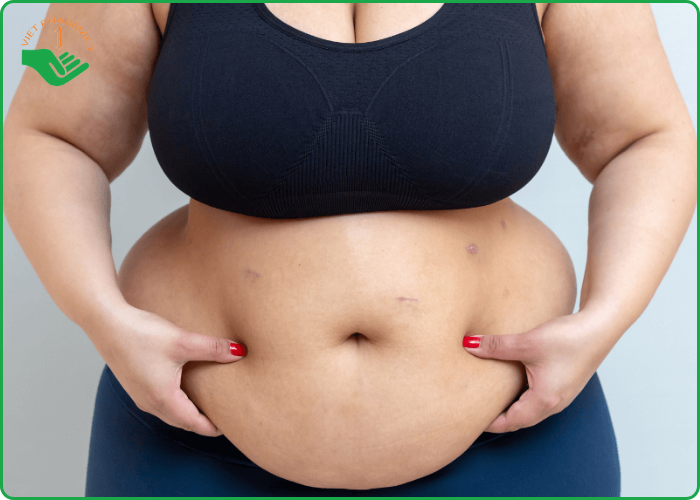 Đường trong kẹo dứa giảm cân tăng nguy cơ tiểu đường type 2 và béo phì