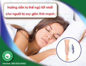 goi-y-tu-the-ngu-tot-nhat-cho-nguoi-bi-suy-gian-tinh-mach-1