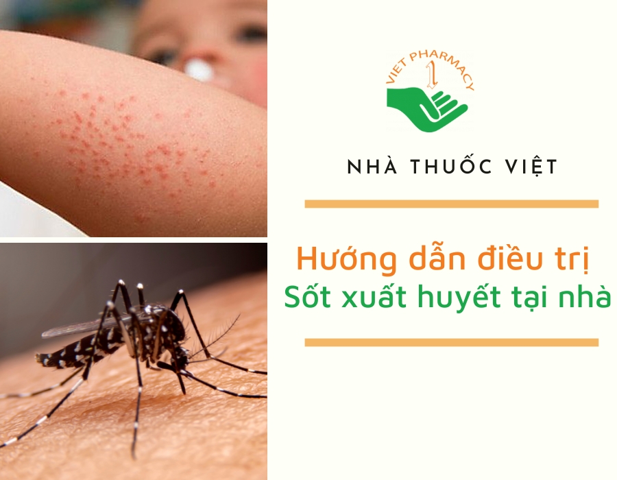 Hướng dẫn điều trị sốt xuất huyết tại nhà