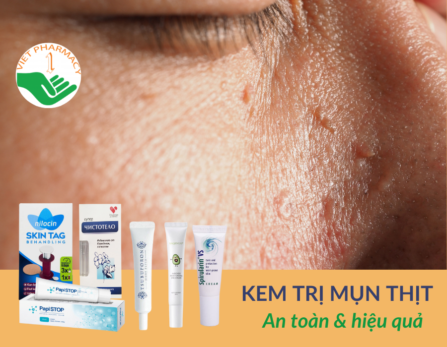 kem-tri-mun-thit-tot-nhat-1 Các loại mụn thịt an toàn và hiệu quả hiện nay