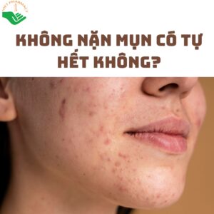 khong-nan-mun-co-tu-het-khong-1