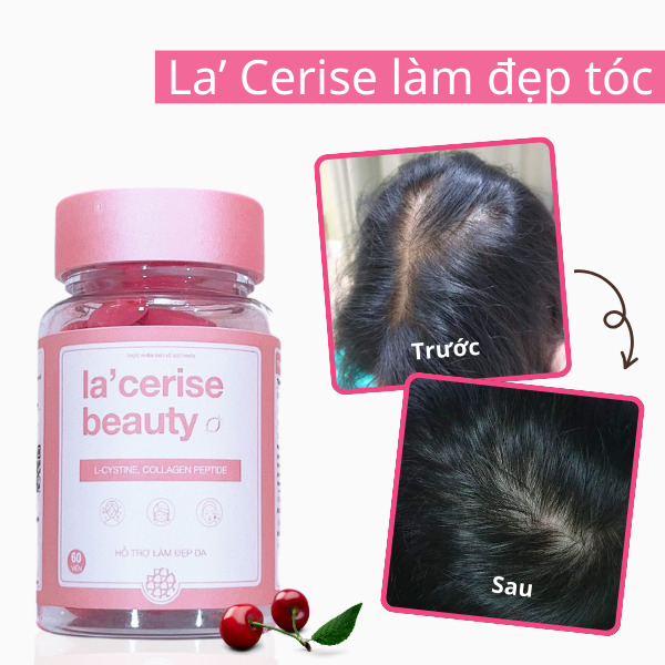 Viên uống đẹp da La’ Cerise làm đẹp tóc