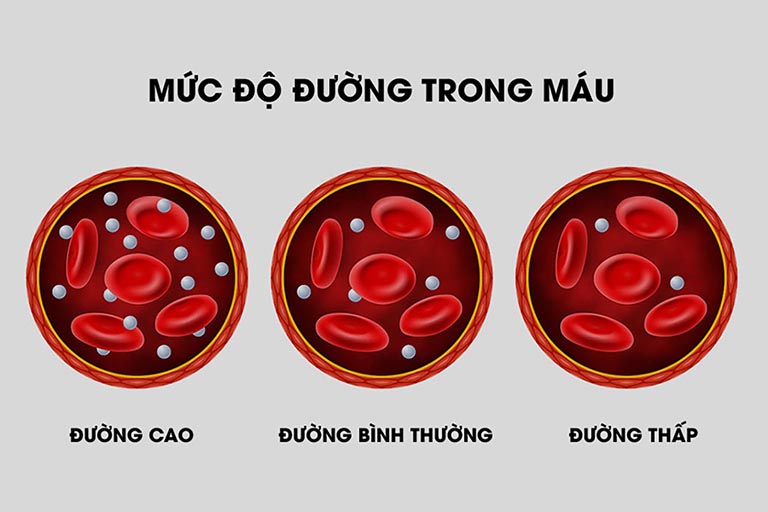 Vì sao cần đo đường huyết thường xuyên?