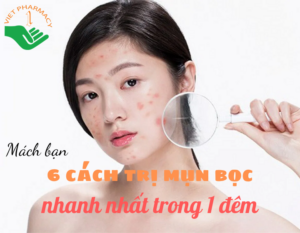 mach-ban-6-cach-tri-mun-boc-nhanh-nhat-trong-1-dem