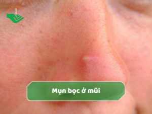 mun-boc-o-mui