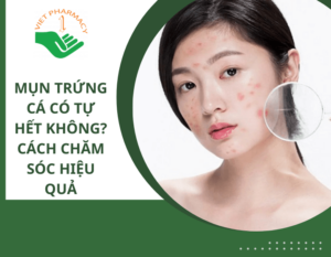 mun-trung-ca-co-tu-het-khong-thumbnail