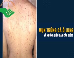 mun-trung-ca-o-lung-thumbnail