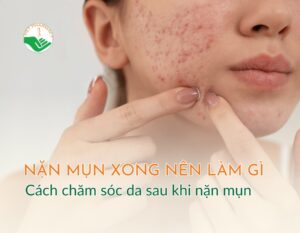 nan-mun-xong-nen-lam-gi