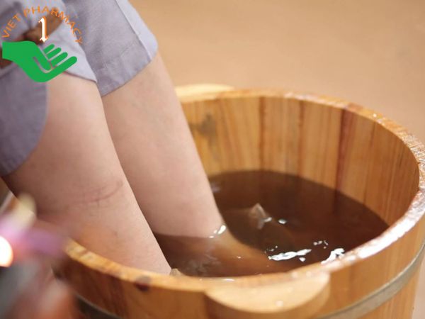 Bị suy giãn tĩnh mạch bạn nên áp dụng nhiều phương pháp điều trị khác nhau