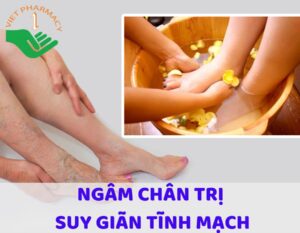 ngam-chan-tri-suy-gian-tinh-mach-thumbnail