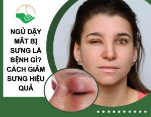 ngu-day-mat-bi-sung-la-benh-gi-thumb