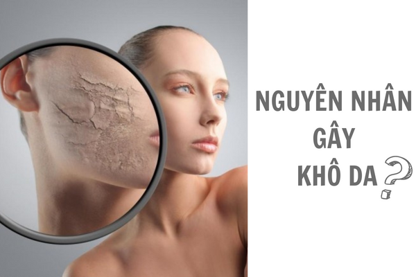 Nguyên nhân gây khô da