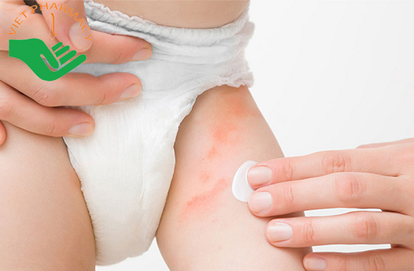 Tình trạng hăm tã ở bé do nhiều nguyên nhân gây nên