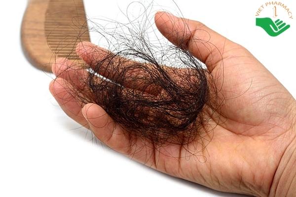 Nguyên nhân rụng tóc